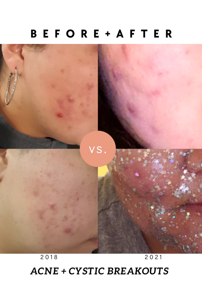 Before and after picture